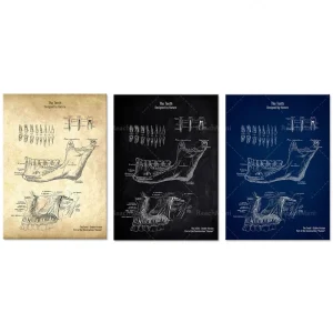 Affiche Anatomie Dentaire Vintage – Art Mural Éducatif Cabinet Dentiste – Style Brevet