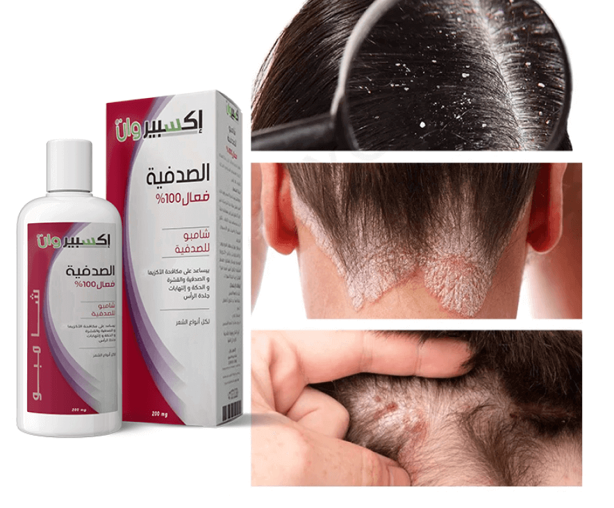 Shampoing Psoriasis d’ExpertOne – Image 3